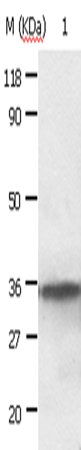 Anti-Human/Mouse/Rat ANXA2 Antibody - ABMIUM