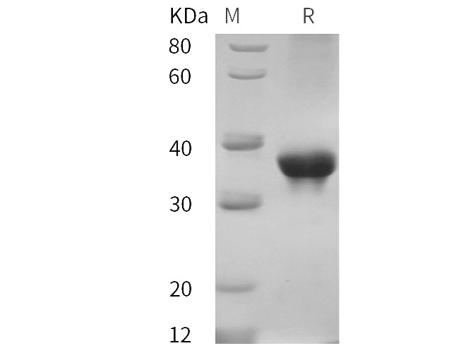 SDS-PAGE analysis of Cynomolgus macaques ABL1 proteins, 2 μg/lane of Recombinant Cynomolgus macaques ABL1 proteins was resolved with SDS-PAGE under reducing conditions, showing bands at 35 kDa.