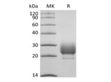 Recombinant Rhesus Macaque CD79B/B29 (C-6His) - ABMIUM