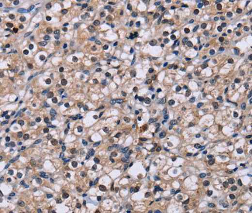 Anti-Human/Mouse/Rat NR1D1 Antibody