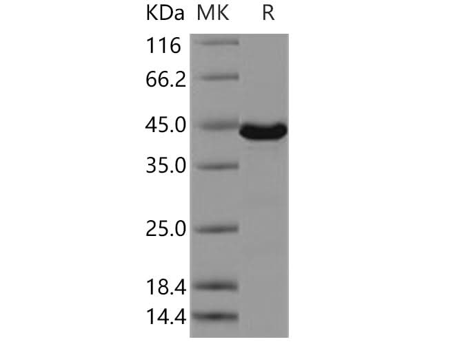 Recombinant Human ERK3/MAPK12 Protein - ABMIUM
