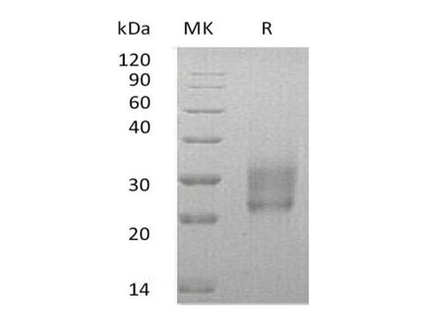 Recombinant Human HAI-2/SPINT2 Protein (His Tag) - ABMIUM