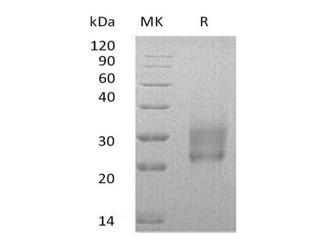 Recombinant Human HAI-2/SPINT2 Protein (His Tag) - ABMIUM