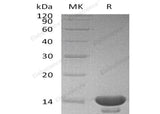 Recombinant Human Cystatin C/CST3 Protein (E.coli) - ABMIUM