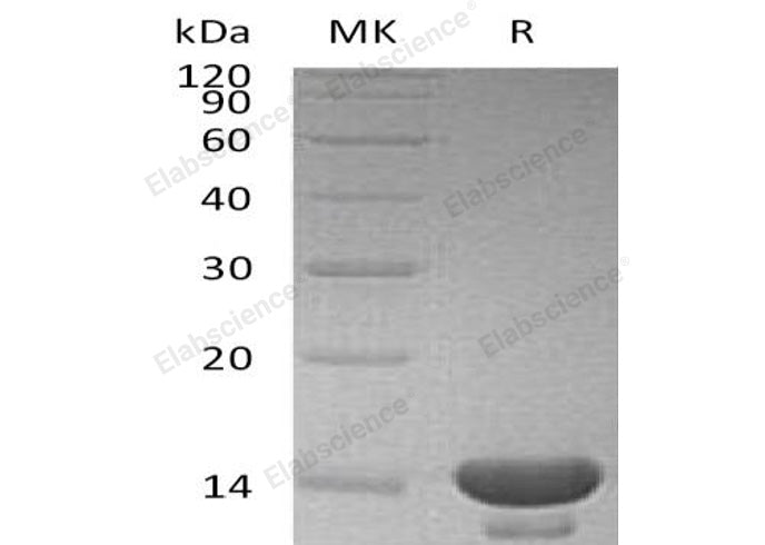 Recombinant Human Cystatin C/CST3 Protein (E.coli) - ABMIUM