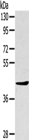 Anti-Human/Mouse TNIP2 Antibody - ABMIUM
