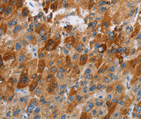 Anti-Human/Mouse CCR9 Antibody - ABMIUM