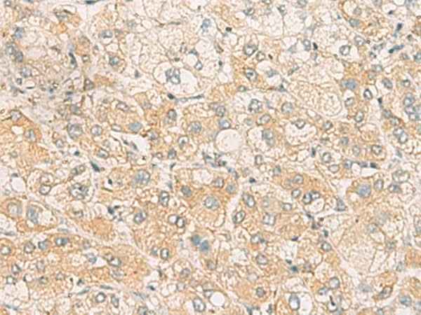 Anti-Human SYNGR1 Antibody