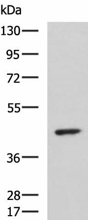 Western blot analysis of Hela cell lysate using ARPC1B Polyclonal Antibody at dilution of 1:1000