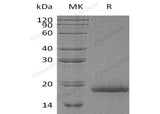 Recombinant Human Protachykinin-1/TAC1 Protein (His Tag) - ABMIUM