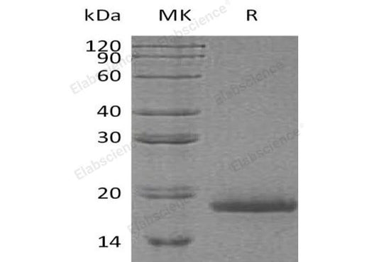 Recombinant Human Protachykinin-1/TAC1 Protein (His Tag) - ABMIUM