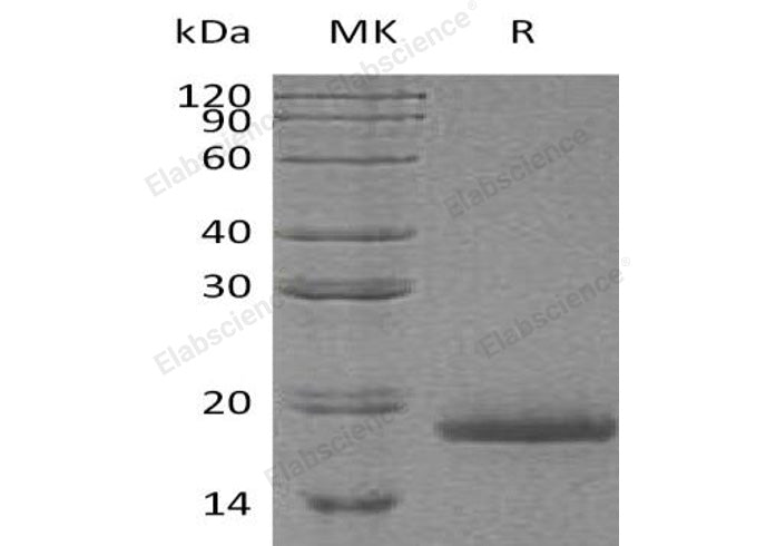 Recombinant Human Protachykinin-1/TAC1 Protein (His Tag) - ABMIUM