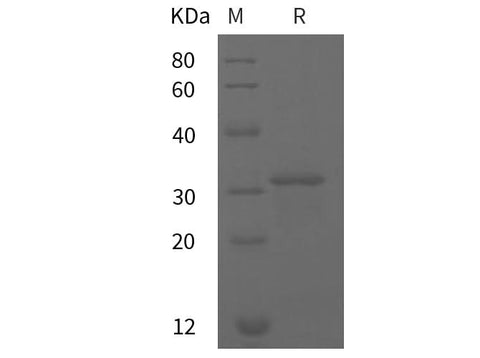 SDS-PAGE analysis of Rat GSTp1 proteins, 2 μg/lane of Recombinant Rat GSTp1 proteins was resolved with SDS-PAGE under reducing conditions, showing bands at 31 kDa.