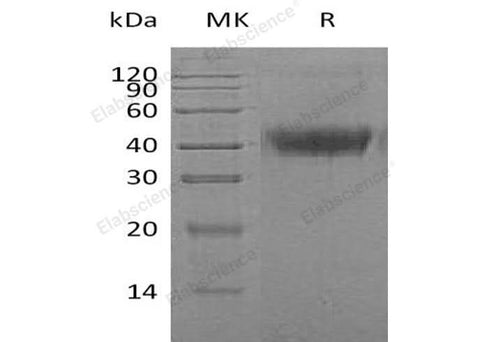 Recombinant Human M-CSF/CSF1 Protein (His Tag) - ABMIUM
