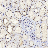 Immunohistochemistry analysis of paraffin-embedded human kidney using JUN Polyclonal Antibody at dilution of 1:1000.
