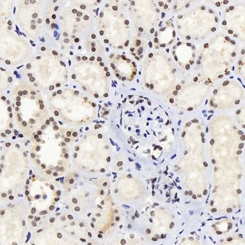Immunohistochemistry analysis of paraffin-embedded human kidney using JUN Polyclonal Antibody at dilution of 1:1000.