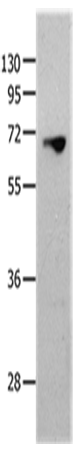 Anti-Human MMP25 Antibody - ABMIUM