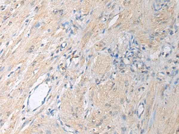 Anti-Human/Mouse/Rat GNAI1 Antibody
