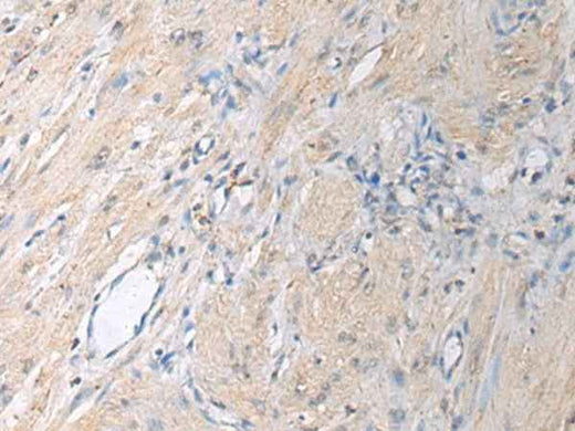 Anti-Human/Mouse/Rat GNAI1 Antibody