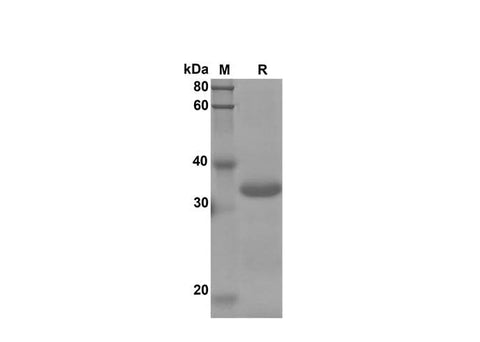 SDS-PAGE analysis of Mouse CXCL4/PF4 proteins, 2 μg/lane of Recombinant Mouse CXCL4/PF4 proteins was resolved with SDS-PAGE under reducing conditions, showing bands at 34 kDa.