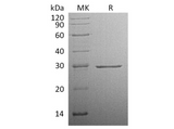 Recombinant Human Factor D Protein (His Tag) - ABMIUM