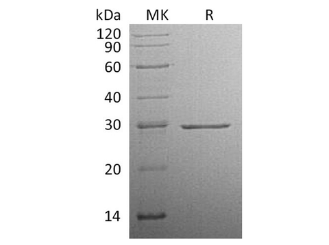 Recombinant Human Factor D Protein (His Tag) - ABMIUM