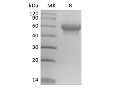 Recombinant Mouse IL-6 Receptor Subunit alpha/IL-6RA/CD126 (C-6His) - ABMIUM