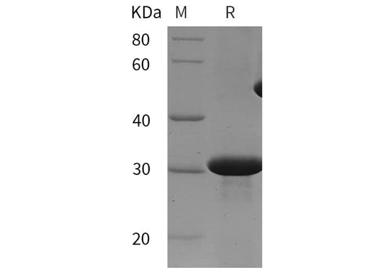 SDS-PAGE analysis of Mouse TGFBR2 proteins, 2 μg/lane of Recombinant Mouse TGFBR2 proteins was resolved with SDS-PAGE under reducing conditions, showing bands at 32 kDa.