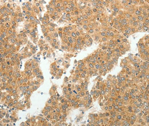 Anti-Human/Mouse/Rat GEMIN2 Antibody - ABMIUM