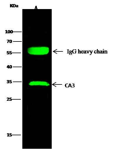Anti-Human CA3 Antibody [B111] - ABMIUM