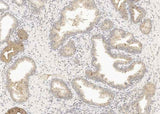 Anti-Human GDF15 Antibody [A879] - ABMIUM