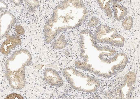 Anti-Human GDF15 Antibody [A879] - ABMIUM