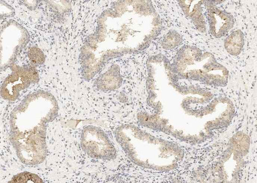Anti-Human GDF15 Antibody [A879] - ABMIUM