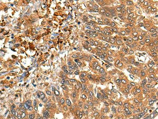 Anti-Human/Mouse/Rat MARK3 Antibody