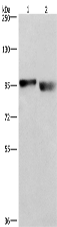 Anti-Human/Mouse KIAA1524 Antibody - ABMIUM
