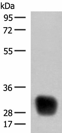 Western blot analysis of Raji cell lysate using HLA-DRB4 Polyclonal Antibody at dilution of 1:350