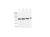 Anti-Mouse/Rat MMP-2 Antibody - ABMIUM