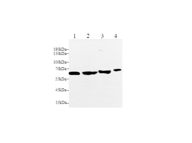 Anti-Mouse/Rat MMP-2 Antibody - ABMIUM
