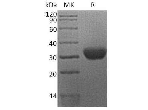 Recombinant Human Erythropoietin R/EPOR Protein (His Tag) - ABMIUM