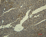 Immunohistochemistry of paraffin-embedded Rat liver tissue using Transferrin Monoclonal Antibody at dilution of 1:50.
