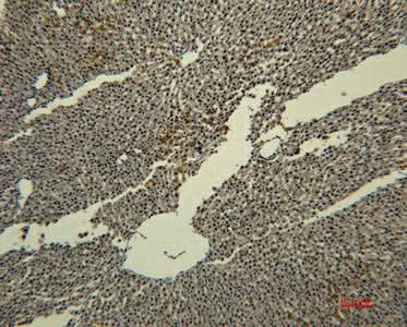 Immunohistochemistry of paraffin-embedded Rat liver tissue using Transferrin Monoclonal Antibody at dilution of 1:50.