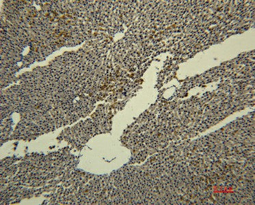 Immunohistochemistry of paraffin-embedded Rat liver tissue using Transferrin Monoclonal Antibody at dilution of 1:50.