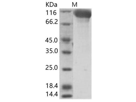 Recombinant Hendra virus (HeV) (isolate Horse/Autralia/Hendra/1994) Glycoprotein Protein (Fc Tag) - ABMIUM