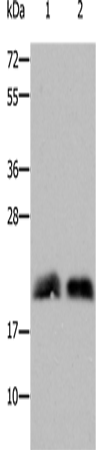 Anti-Human/Mouse/Rat RHOB Antibody - ABMIUM