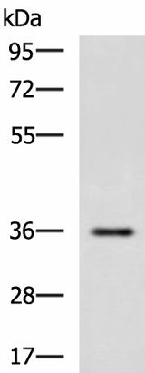 Western blot analysis of Human fetal liver tissue lysate using IBSP Polyclonal Antibody at dilution of 1:650