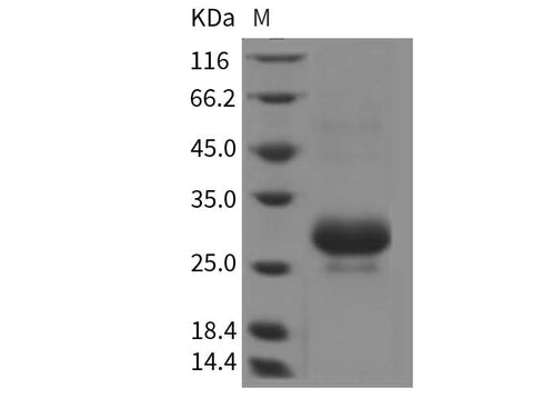 Recombinant Rat CTHRC1 Protein (His Tag) - ABMIUM