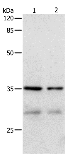 Anti-Human/Mouse/Rat CDK4 Antibody - ABMIUM