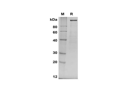 SDS-PAGE analysis of Human NRP2 proteins, 2 μg/lane of Recombinant Human NRP2 proteins was resolved with SDS-PAGE under reducing conditions, showing bands at 120 kDa.
