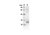 SDS-PAGE analysis of Human FCER2 proteins, 2 μg/lane of Recombinant Human FCER2 proteins was resolved with an SDS-PAGE under reducing conditions, showing bands at 18.8 kDa.