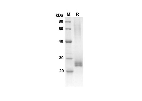 SDS-PAGE analysis of Human FCER2 proteins, 2 μg/lane of Recombinant Human FCER2 proteins was resolved with an SDS-PAGE under reducing conditions, showing bands at 18.8 kDa.